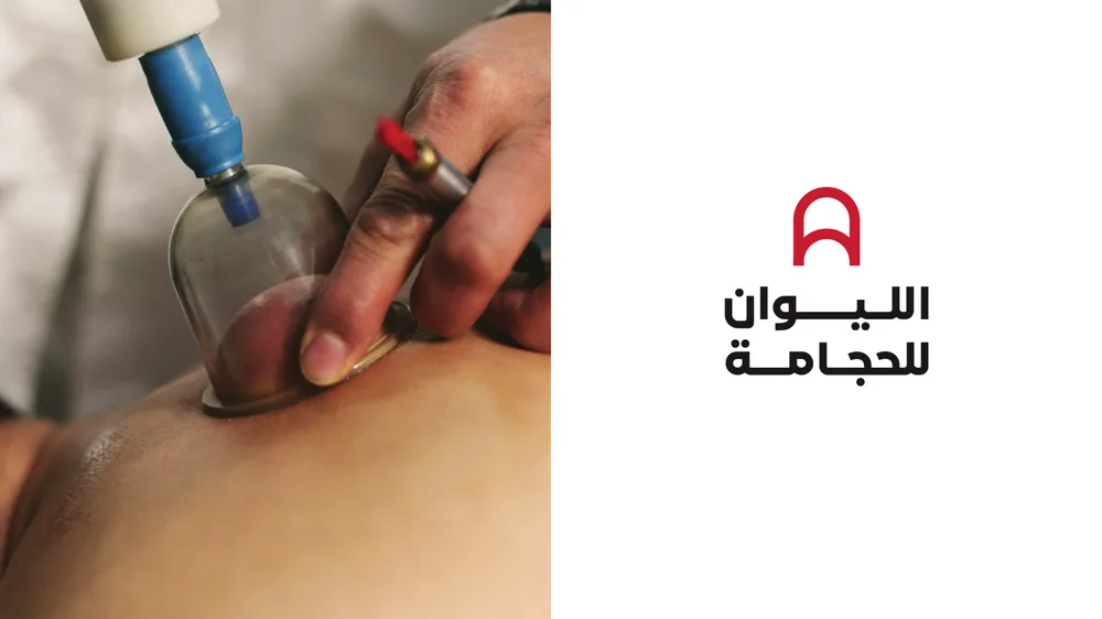 Aliwan Cupping Arabic logo in red and black, beside a photograph of a cupping cup in use